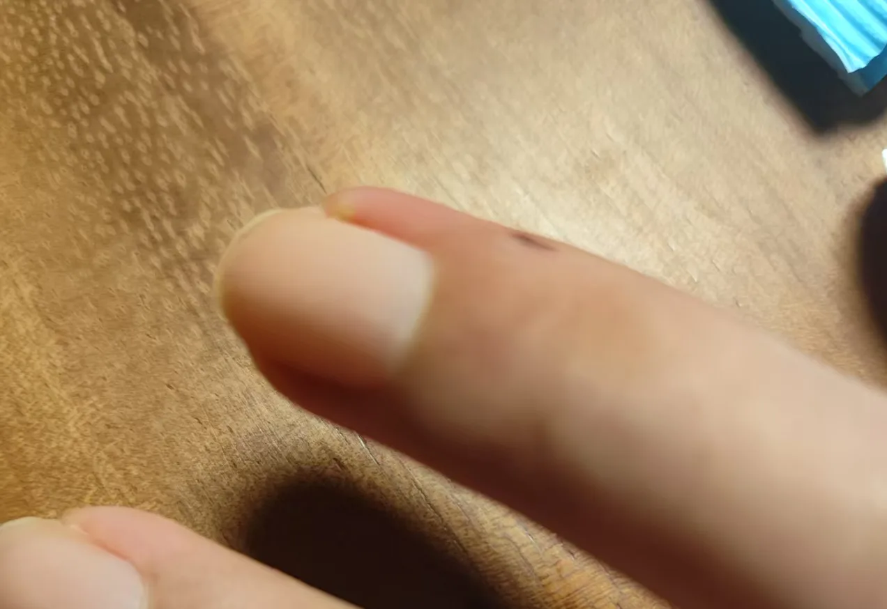 记录一次手贱